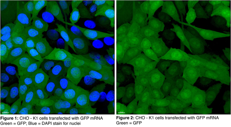 ald-Treated-GFP-mRNA-DAPI