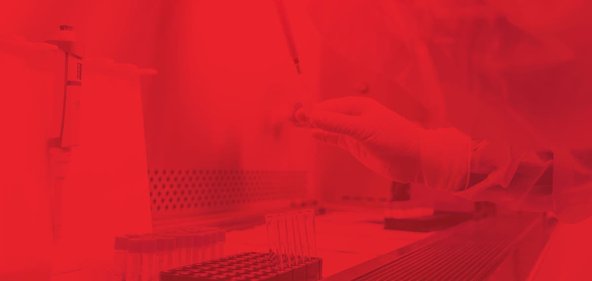 In-Stock GMP Plasmid DNA: Supporting Lentiviral and AAV Vector Programs ...